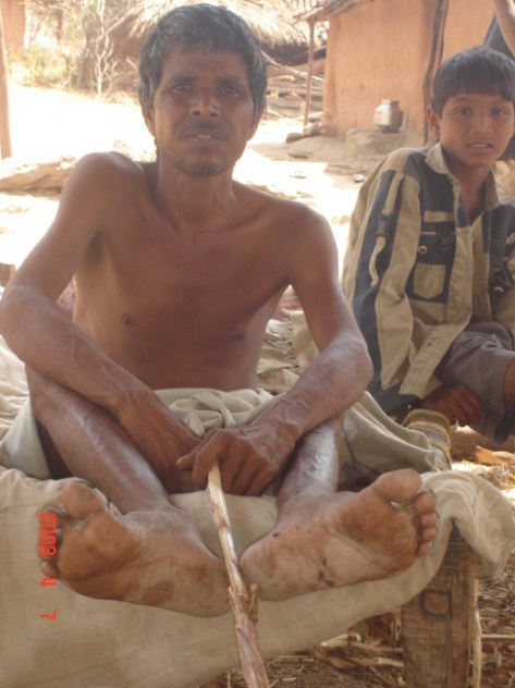 Fakira Veersing Damor,Chitrodiya